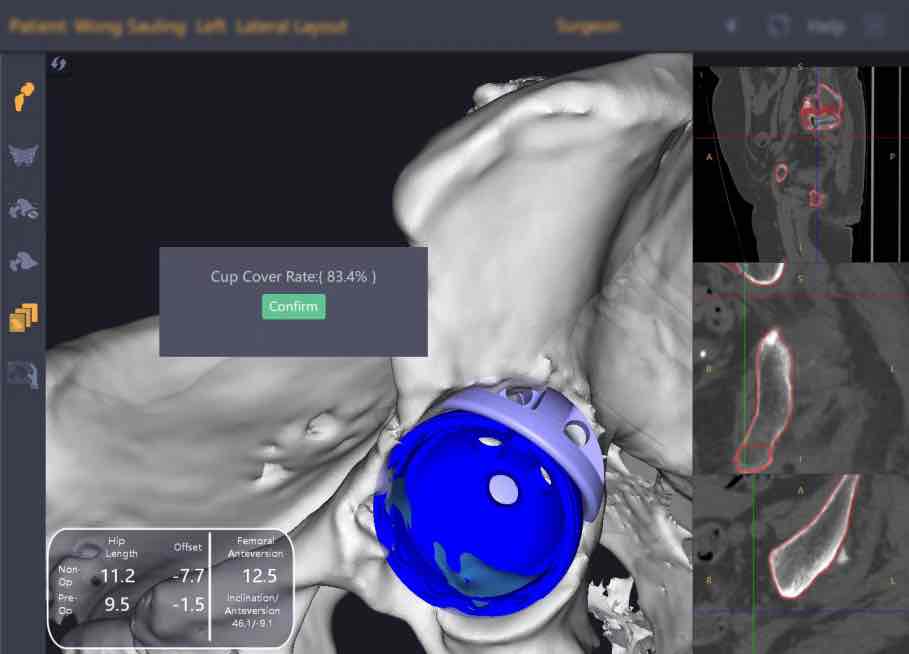 ȫ����������ҽ���Ŷӽ����螻����ˡ�����ľ�� �ؽ������Ź�